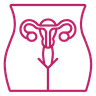 Lower Uterine Segment Caesarean Section icon