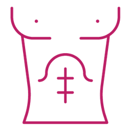 Abdominal Myomectomy