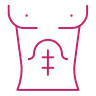 Abdominal Myomectomy icon