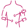 Laparoscopic Cystectomy icon