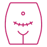 Exploratory Laparotomy Proceed icon