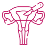 Laparoscopic Hysterectomy icon