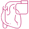 Permanent Pacemaker Implantation PPI icon