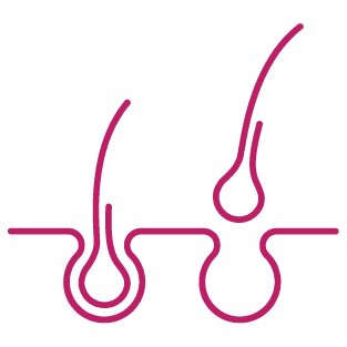 procedure image