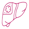 Transjugular Intrahepatic Portosystemic Shunt TIPS icon