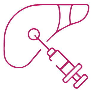 procedure image
