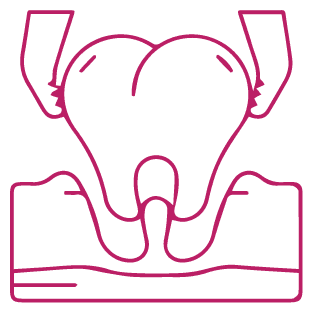 procedure image