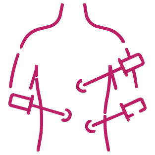 procedure image