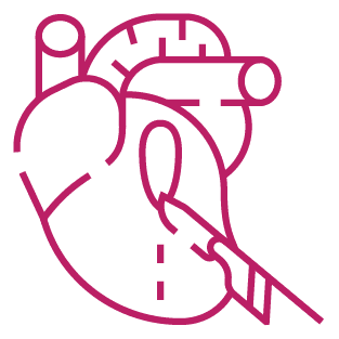 procedure image