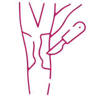 procedure image