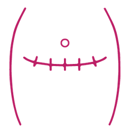 Abdominal Hysterectomy
