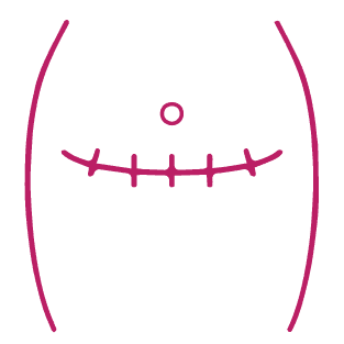 procedure image