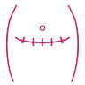 Abdominal Hysterectomy icon
