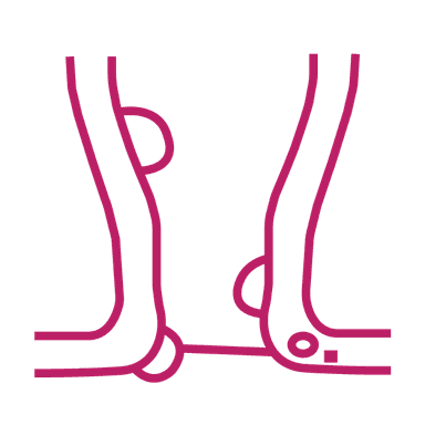 procedure image