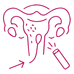 procedure image