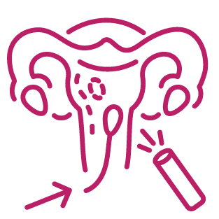 procedure image