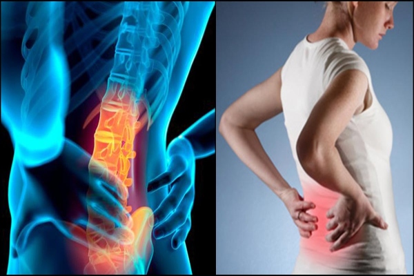 Causes Remedies For Back Pain After C Section Ujala Cygnus