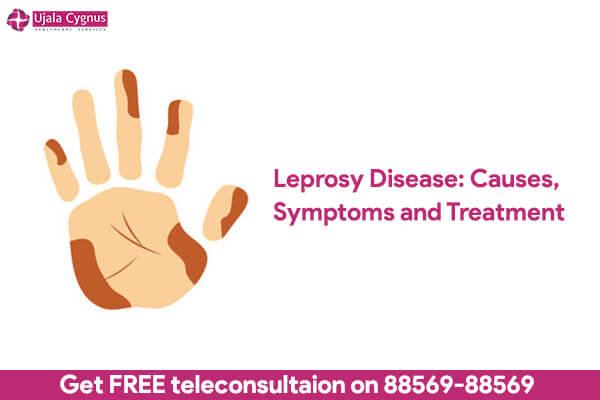 Leprosy Disease: Causes, Symptoms and Treatment