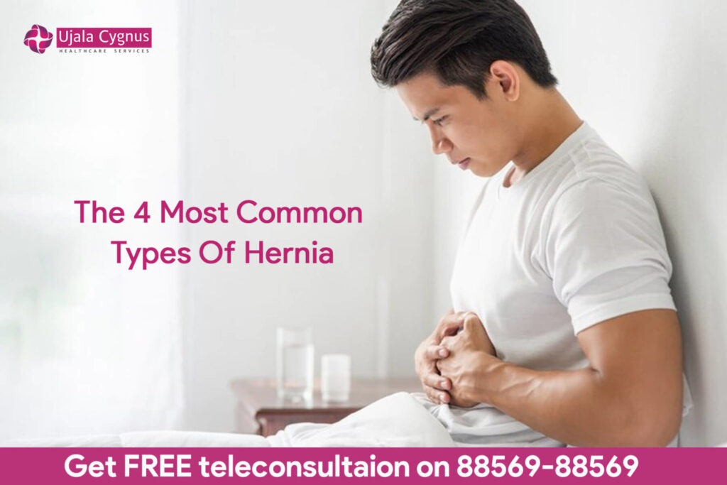 What Is The Understanding Of Hernia Types