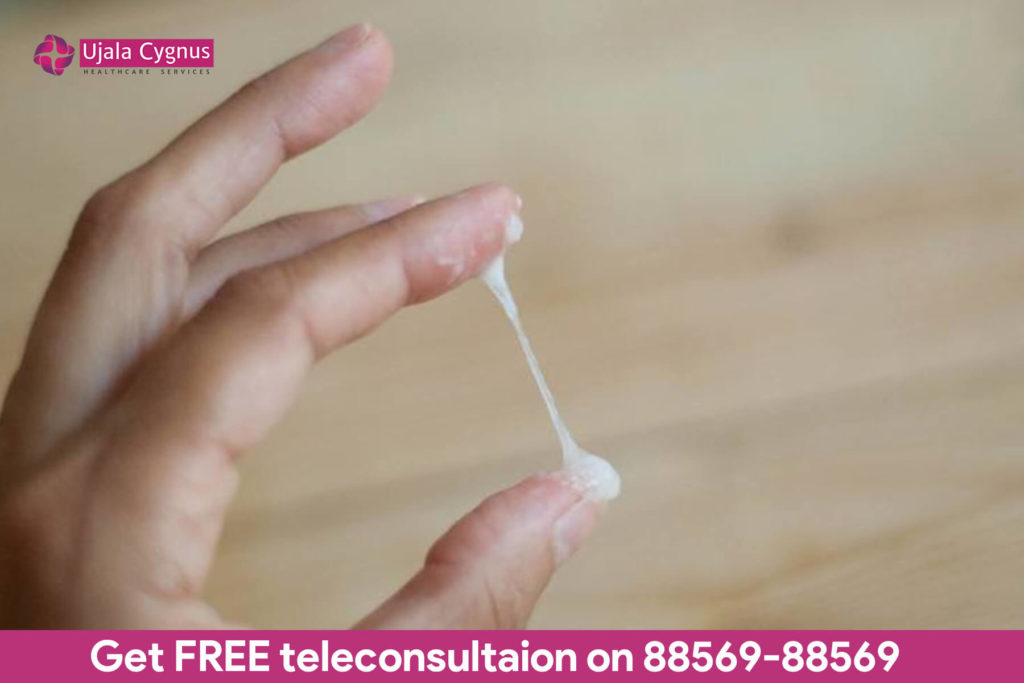 White Vaginal Discharge Yeast Infection   White Discharge 3  1024x683 