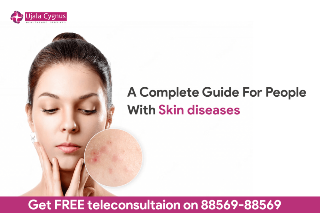 A Complete Guide For People With Skin Diseases