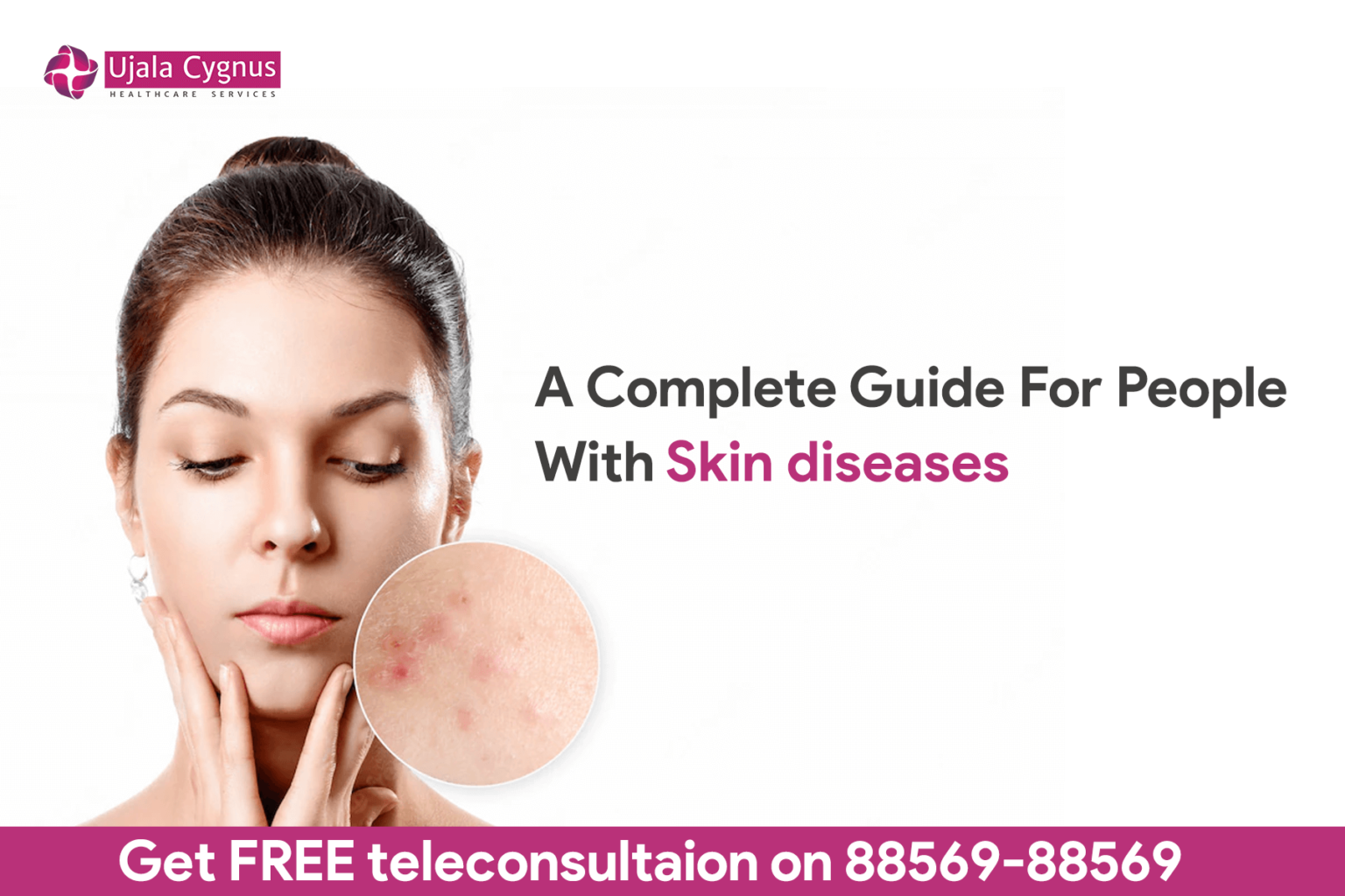 A Complete Guide For People With Skin Diseases Ujala Cygnus