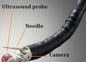 Endoscopic Ultrasound Probes (EUS)