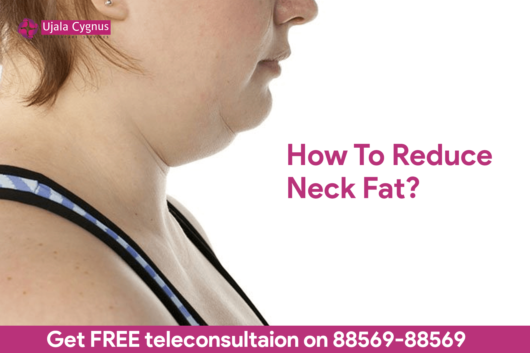 How To Reduce Neck Fat?