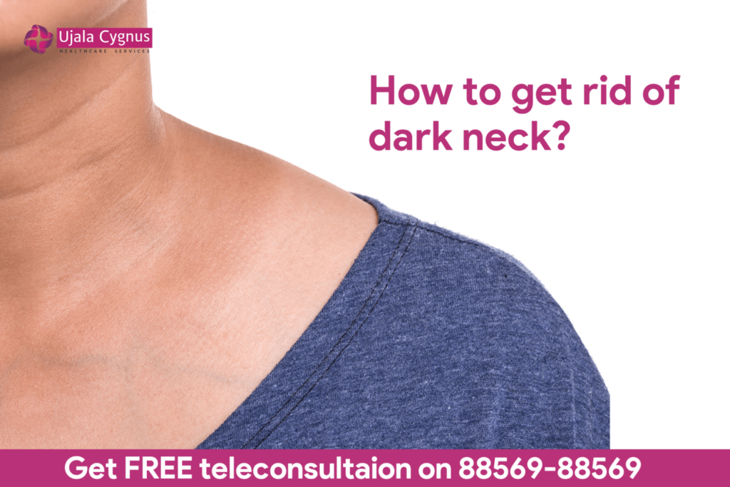 How To Get Rid Of Dark Neck?