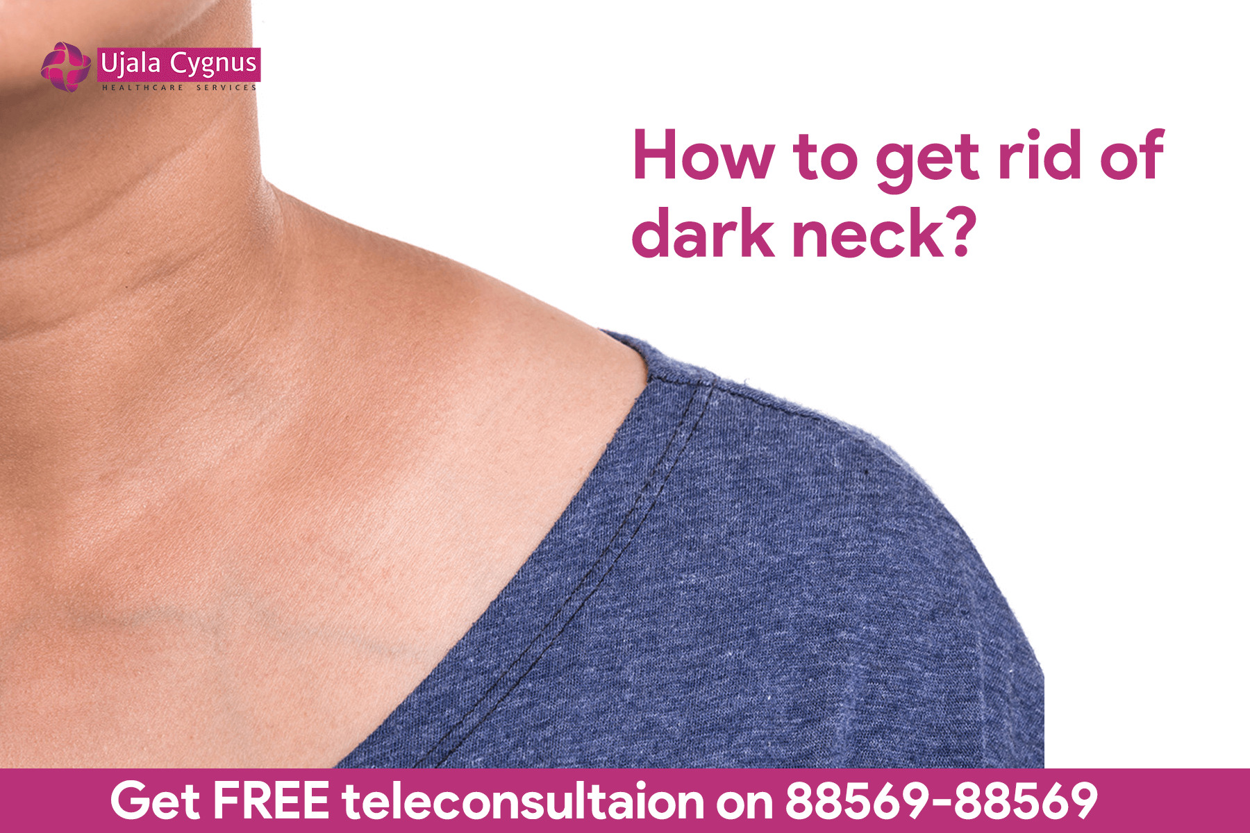 how to get rid of dark neck?