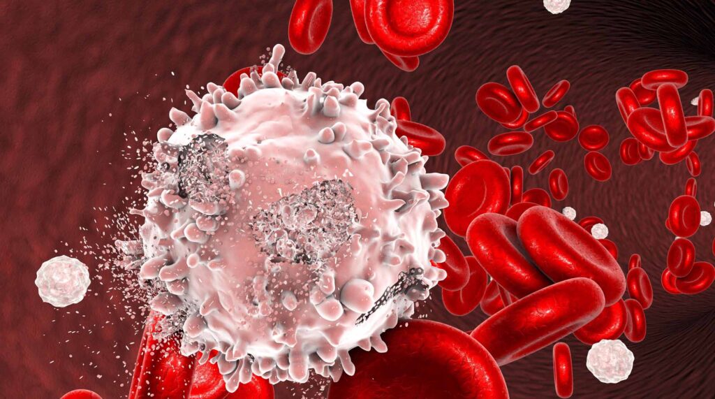 Know more about Blood cancer