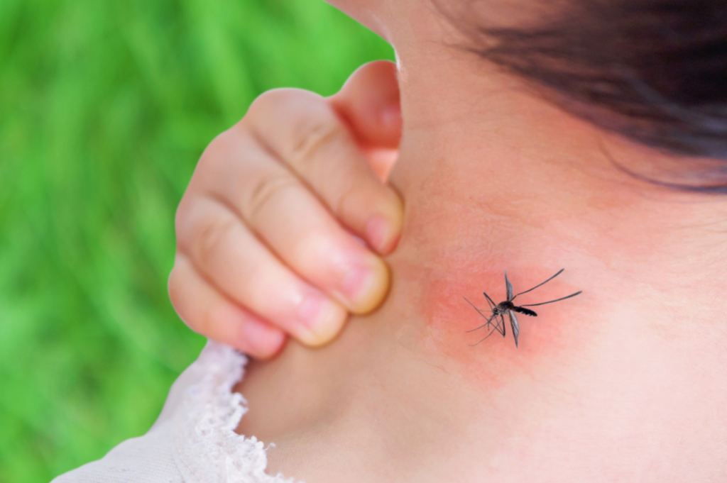 डेंगू के लक्षण और उपाय