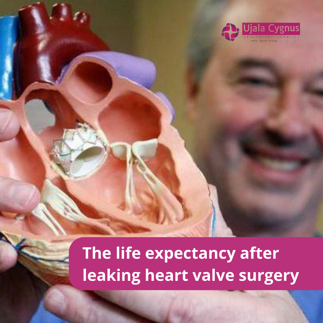 What Is The Life Expectancy Of A Leaking Heart Valve Ujala Cygnus