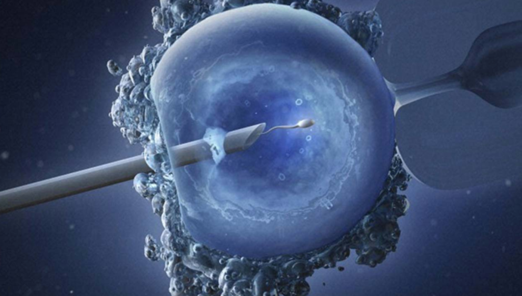 IVF तकनीक द्वारा अपने ही एग और स्पर्म से बन सकते हैं पेरेंट्स