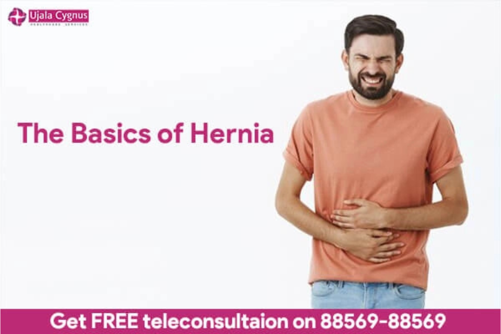 The-basisc-of-hernia