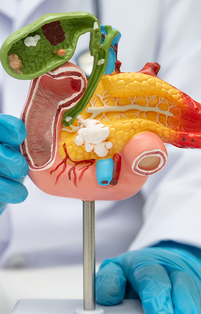 Why Choose Ujala Cygnus Hospitals for Gallbladder Removal Surgery