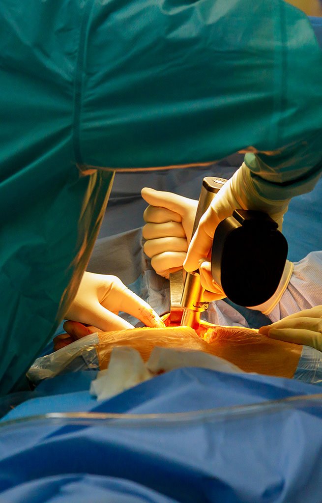 Why Choose Ujala Cygnus Hospitals for Hernia Repair Surgery