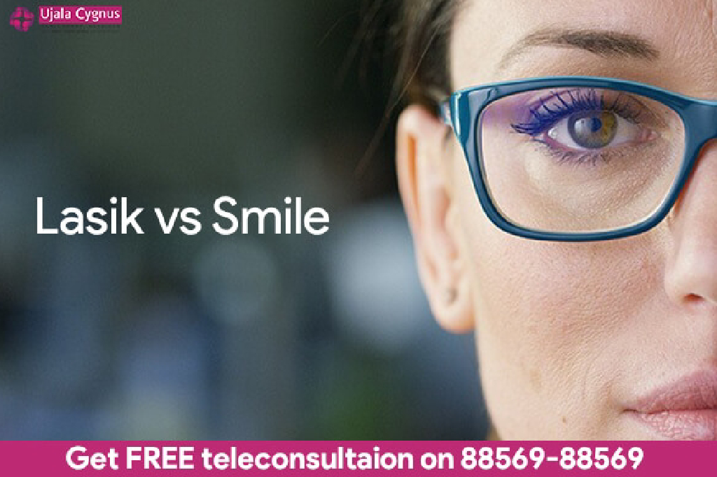 LASIK vs SMILE