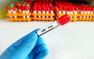 CRP-Test-What-High-C-Reactive-Protein-Levels-Mean-Common-Causes-and-Treatment.webp