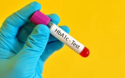HbA1c-Test-Explained-Normal-Ranges-Diabetes-Levels-and-How-to-Read-Your-Results