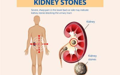 Kidney Stones: Know the Warning Signs Before They Become a Bigger Problem