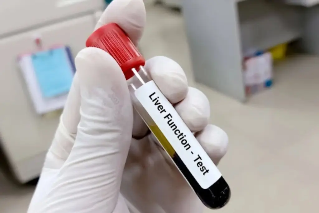 SGPT-vs-SGOT-Key-Differences-Normal-Ranges-and-What-High-Levels-Mean.