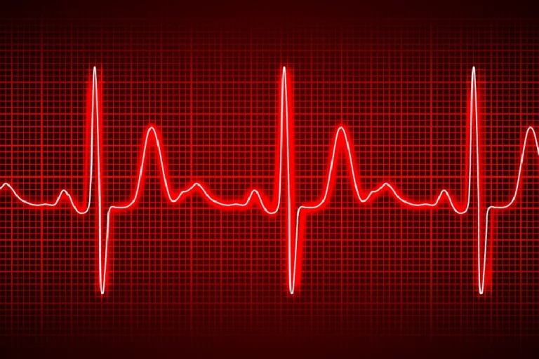 irregular-heartbeat-arrhythmia-img